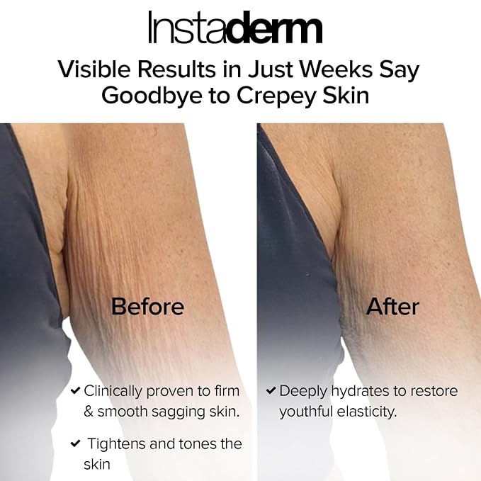 Crepe Fix Body Restorative Cream – Anti-Aging Wrinkle Cream, Support Skins - Image 3