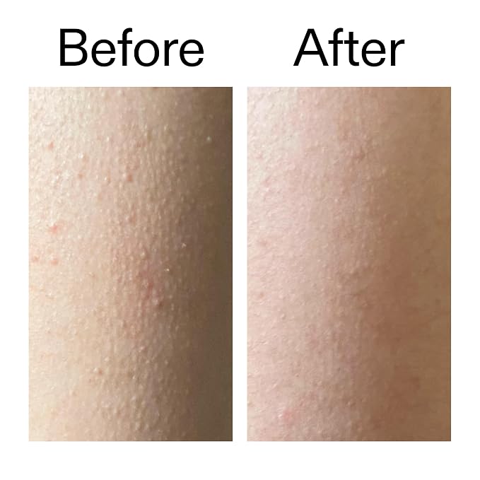 The INKEY List Glycolic Acid Exfoliating Body Stick 45g, One Targeted Solution - Image 7