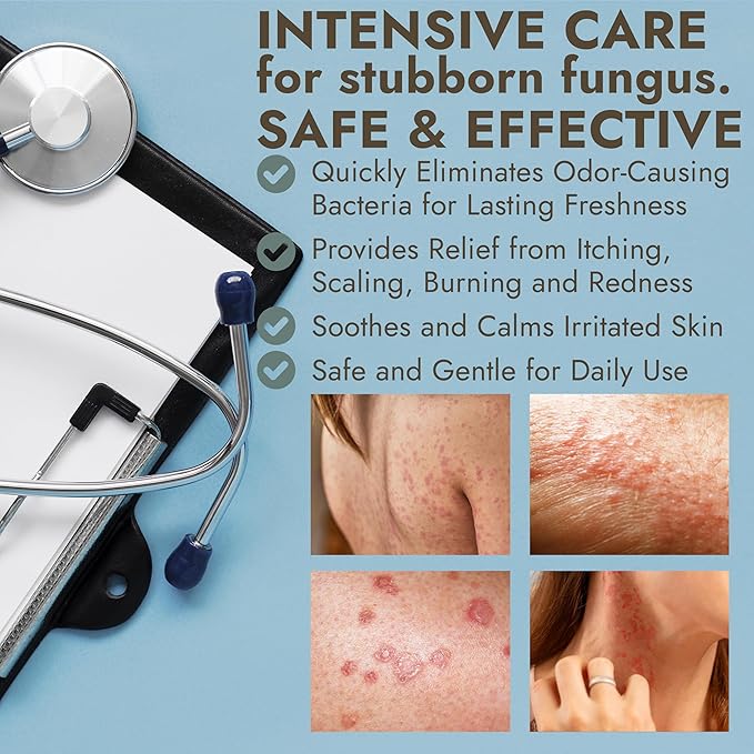Antifungal Body Cream for Ringworm & Athlete’s Foot | Strength Formula - Image 4