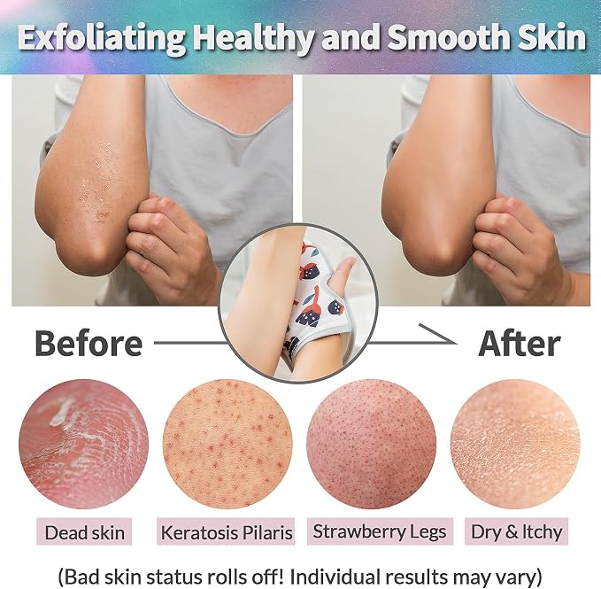 Deep Exfoliating Mitt 2PCS: Double-Sided Glove - Image 5
