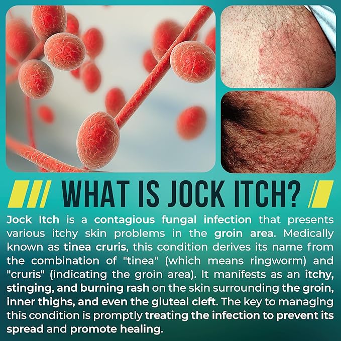 Jock Itch Cream | Extra Strength Antifungal Treatment - Image 5